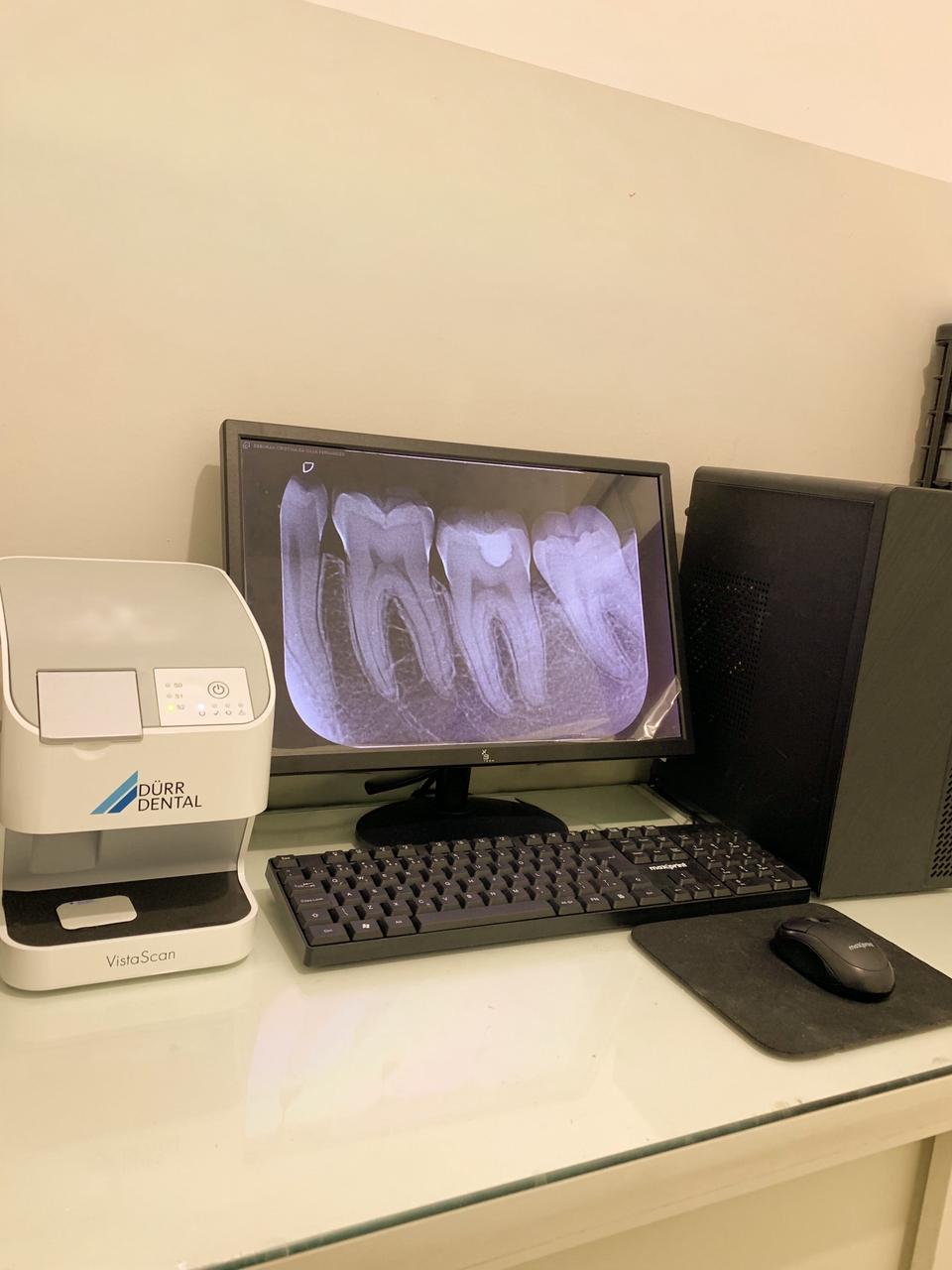Equipamento de radiografia digital Dürr Dental VistaScan na Vitare